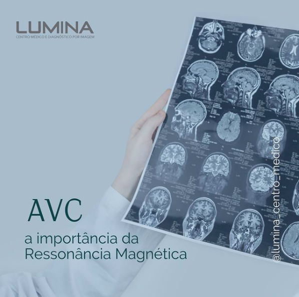 Read more about the article AVC a importância da Ressonância Magnética