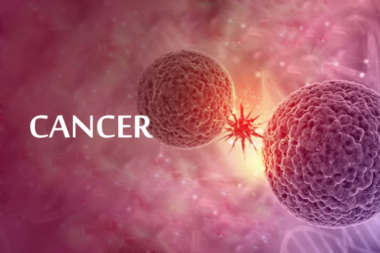 Read more about the article Câncer e Diagnóstico