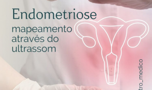 Endometriose – Mapeamento através do ultrassom