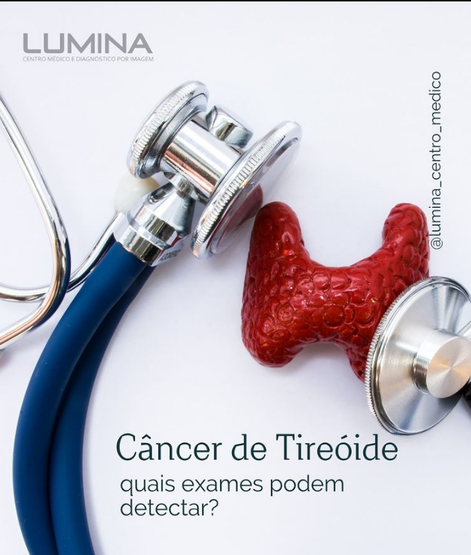 Read more about the article Câncer de tireóide