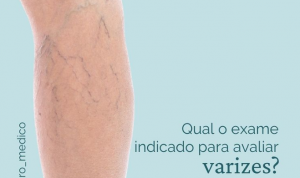 Qual exame indicado para avaliar varizes