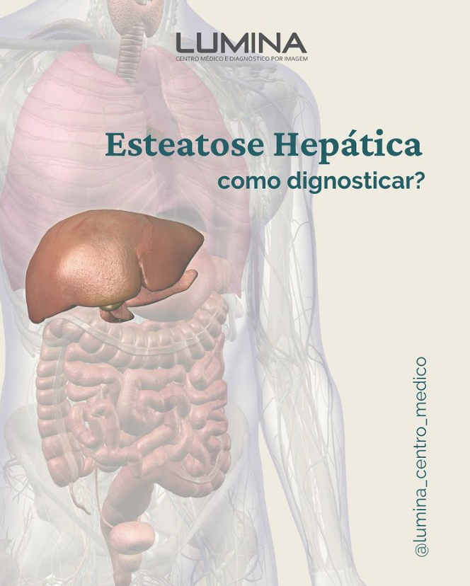 Read more about the article Esteatose Hepática, como diagnosticar?