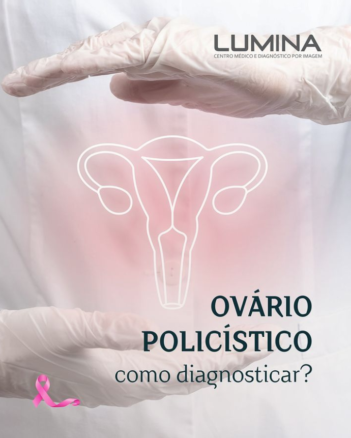 Read more about the article OVÁRIO POLICÍSTICO