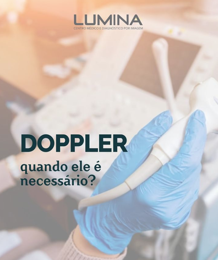 Read more about the article Doppler: Uma Ferramenta Valiosa na Avaliação Vascular