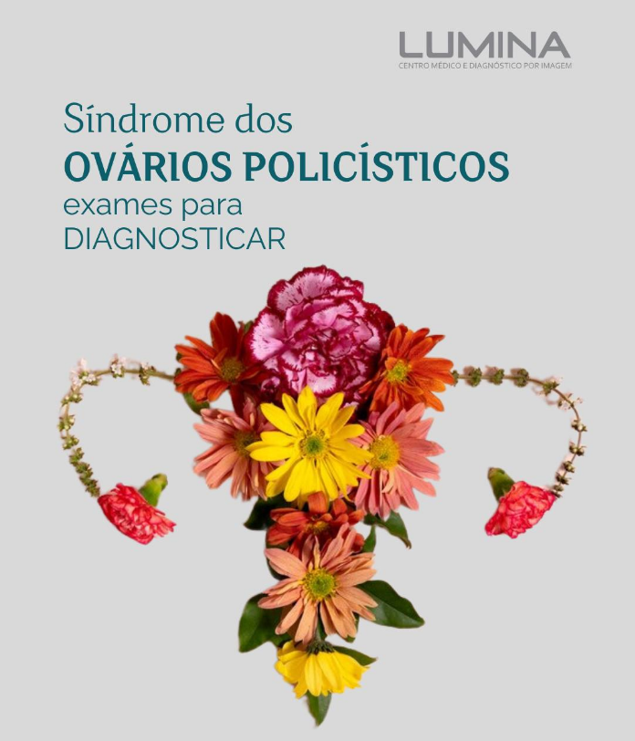 Read more about the article Desvendando a Síndrome dos Ovários Policísticos: Compreensão e Gerenciamento