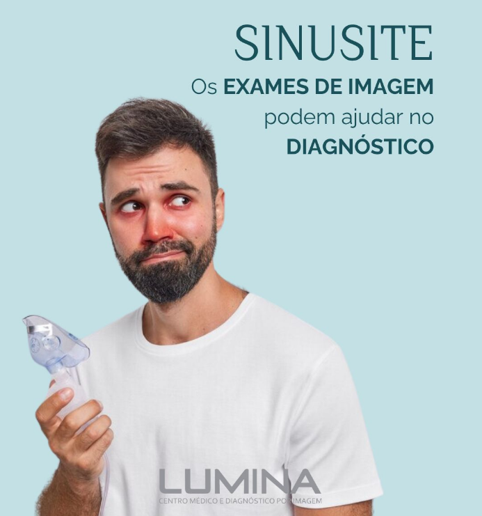 Read more about the article Sinusite: Desvendando os Mistérios por Trás da Dor de Cabeça