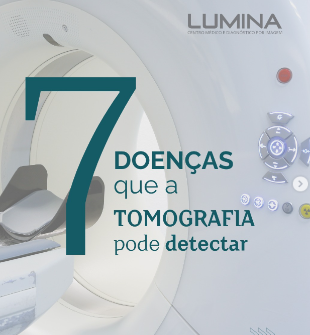 Read more about the article 7 Doenças que a Tomografia Pode Detectar