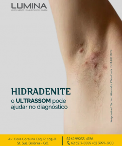 Read more about the article Hidradenite: O ultrassom pode ajudar no diagnóstico?