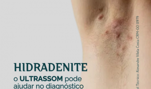 Hidradenite: O ultrassom pode ajudar no diagnóstico?