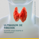 Ultrassom de Tireoide: Quando esse exame é necessário?