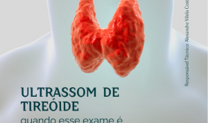 Ultrassom de Tireoide: Quando esse exame é necessário?