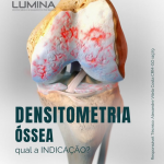 A Densitometria Óssea – Qual a Indicação?