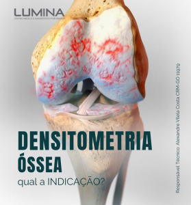 Read more about the article A Densitometria Óssea – Qual a Indicação?