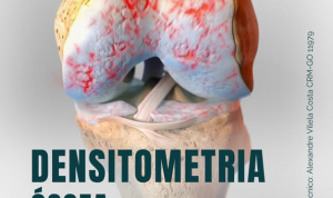 A Densitometria Óssea – Qual a Indicação?