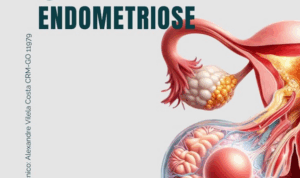 5 Coisas que Você Precisa Evitar se Tem Endometriose