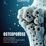 Osteoporose: conheça, previna e cuide dos seus ossos