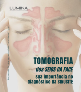 Leia mais sobre o artigo Tomografia dos Seios da Face: quando é indicada e o que ela revela