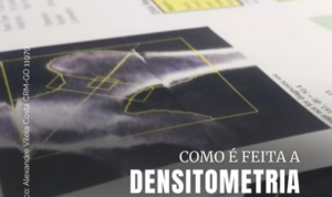 Densitometria Óssea: como é feita e por que é tão importante