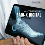 Vantagens do Raio-X Digital: tecnologia, rapidez e mais segurança no diagnóstico