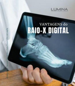 Leia mais sobre o artigo Vantagens do Raio-X Digital: tecnologia, rapidez e mais segurança no diagnóstico