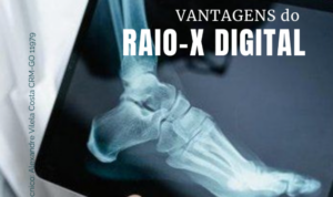 Vantagens do Raio-X Digital: tecnologia, rapidez e mais segurança no diagnóstico