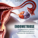 Endometriose: entenda os sinais e cuide da sua saúde