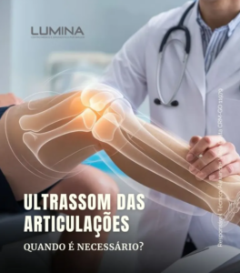 Leia mais sobre o artigo Ultrassom das Articulações: Diagnóstico Preciso e Acessível na Clínica Lumina
