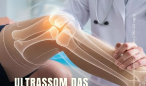 Ultrassom das Articulações: Diagnóstico Preciso e Acessível na Clínica Lumina